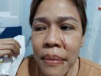 Korban penganiayaan pedagang di pasar jatinegara