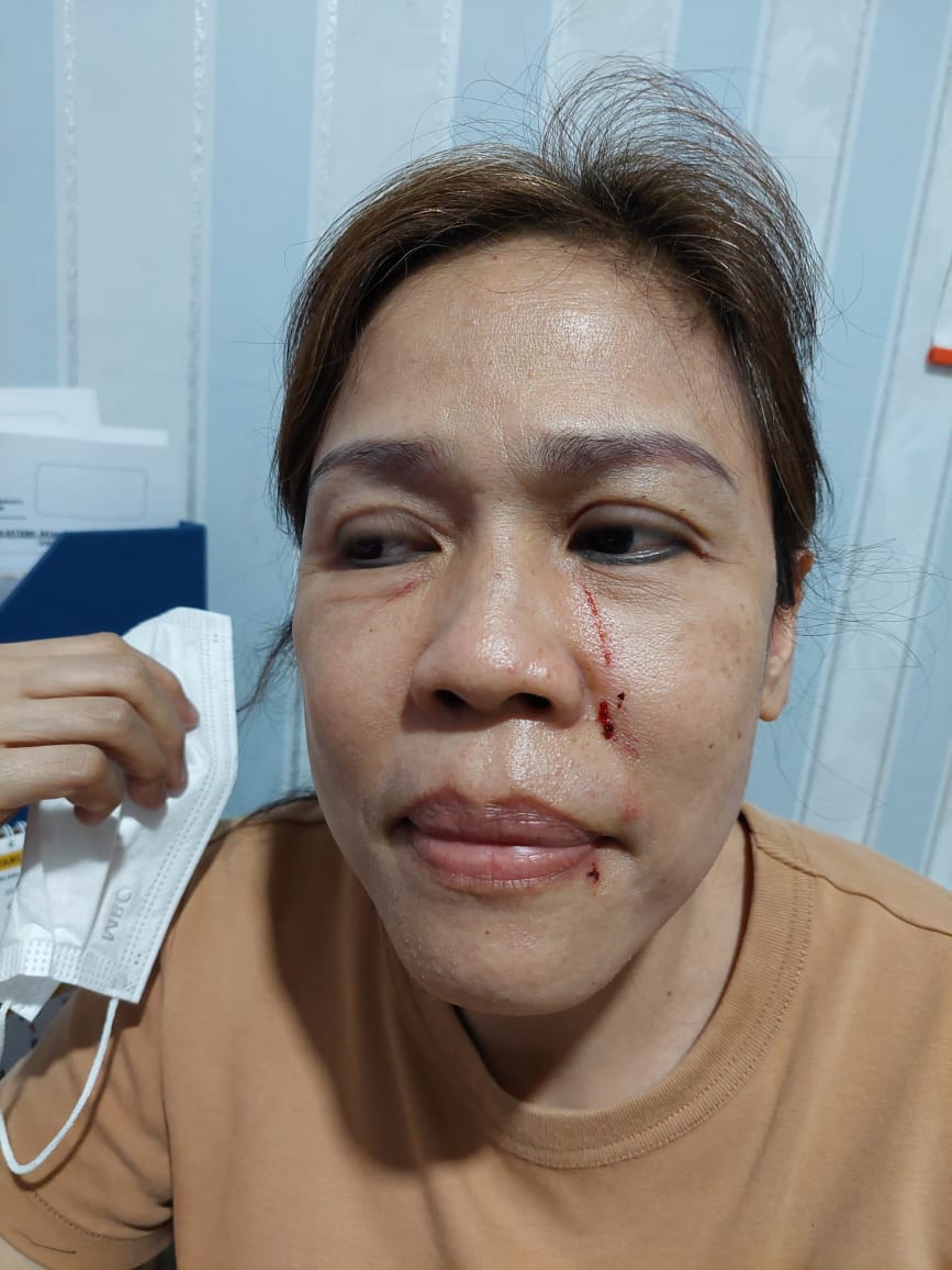 Korban penganiayaan pedagang di pasar jatinegara